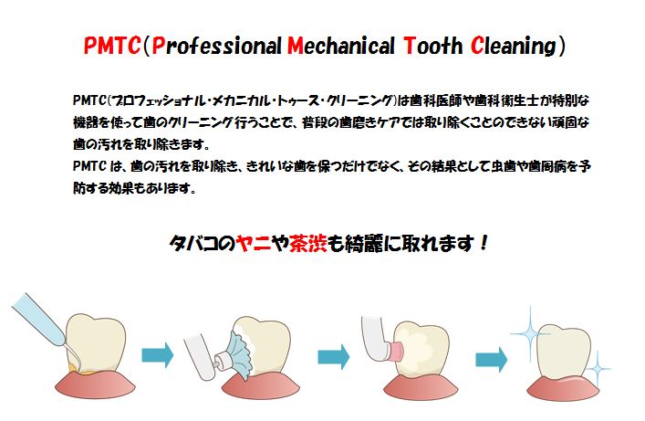 �v���t�F�b�V���i���P�A(PMTC)